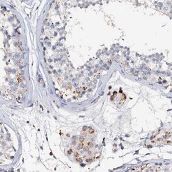 VPS36 Antibody, Novus Biologicals 0.1mL; Unlabeled:Antibodies, Polyclonal